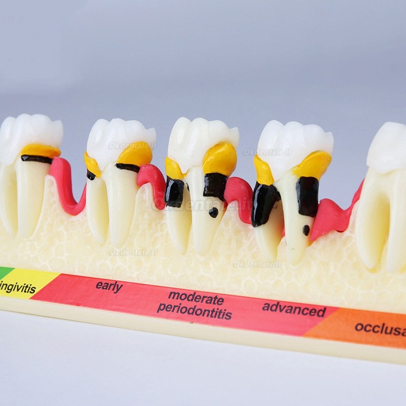 Modello anatomico di classificazione delle malattie